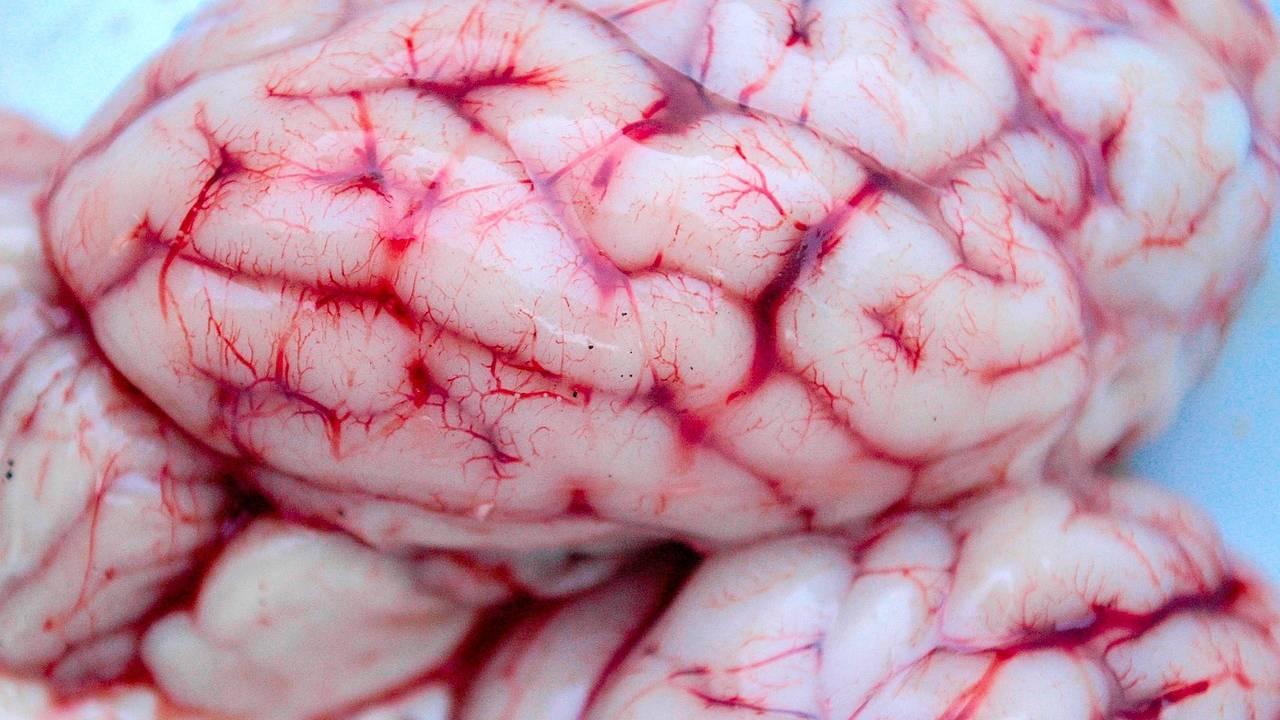Cerebro