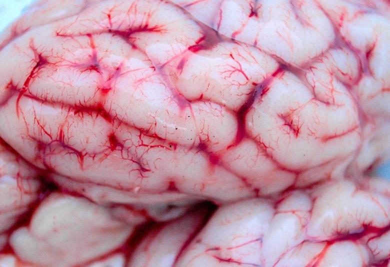 Cerebro