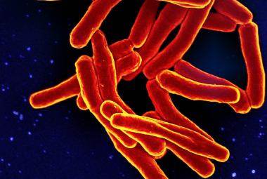 Bacterias