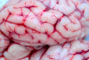 Cerebro